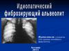 Идиопатический фиброзирующий альвеолит