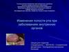 Изменения полости рта при заболеваниях внутренних органов