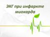 ЭКГ при инфаркте миокарда