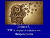 ЭЭГ в норме и патологии. Нейротерапия. Лекция 3