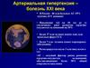Артериальная гипертензия – болезнь XXI века