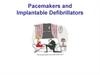 Pacemakers and Implantable Defibrillators
