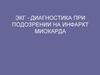 ЭКГ - диагностика при подозрении на инфаркт миокарда
