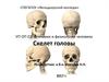 Скелет головы