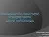 Компьютерная томография. Принцип работы. Шкала Хаунсфильда