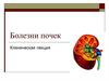 Болезни почек