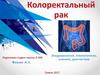 Колоректальный рак