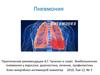 Внебольничная пневмония у взрослых: диагностика, лечение, профилактика