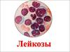Лейкоз . Определение понятия. Значимость лейкозов