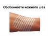 Особенности кожного шва