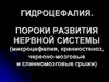 Гидроцефалия. Пороки развития нервной системы (микроцефалия, краниостеноз, черепно-мозговые и спинномозговые грыжи)