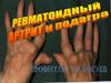 Ревматоидный артрит