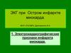 Электрокардиографические признаки инфаркта миокарда