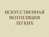 Искусственная вентиляция легких