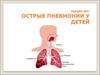 Острые пневмонии у детей. (Лекция 3)