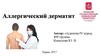Аллергический дерматит