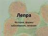 Лепра