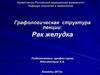 Рак желудка
