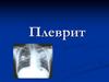 Плеврит. Етіологія