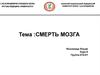 Смерть мозга