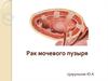 Рак мочевого пузыря