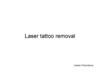Laser tattoo removal