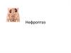 Нефроптаз. Причины развития нефроптоза