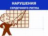Нарушения сердечного ритма