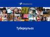 Туберкульоз