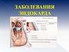 Заболевания эндокарда