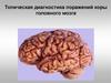 Топическая диагностика поражений коры головного мозга
