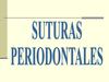 Puntadas en periodoncia