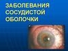 Заболевания сосудистой оболочки