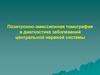 Позитронно-эмиссионная томография в диагностике заболеваний центральной нервной системы