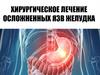 Хирургическое лечение осложненных язв желудка