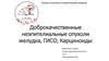 Доброкачественные неэпителиальные опухоли желудка, ГИСО, карциноиды