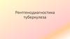 Рентгенодиагностика туберкулеза
