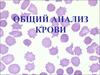 Общий анализ крови
