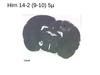 Hirn 14-2 (9-10) 5µ