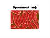 Брюшной тиф