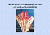 Порядок расследования несчастных случаев на производстве