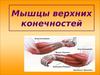 Мышцы верхних конечностей