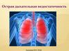 Острая дыхательная недостаточность