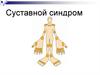 Суставной синдром
