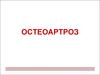 Остеоартроз. Визначення