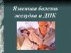 Язвенная болезнь желудка и 12-перстной кишки