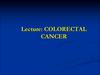 Colorectal cancer
