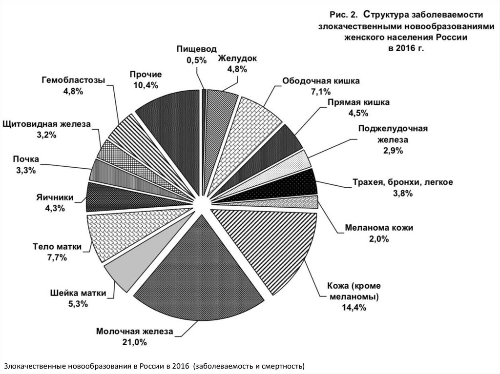 Структура заболеваемости. Структура заболеваемости онкологическими заболеваниями. Структура заболеваемости онкологическими заболеваниями в России. Структура заболеваемости злокачественными новообразованиями. Злокачественные опухоли распространенность.