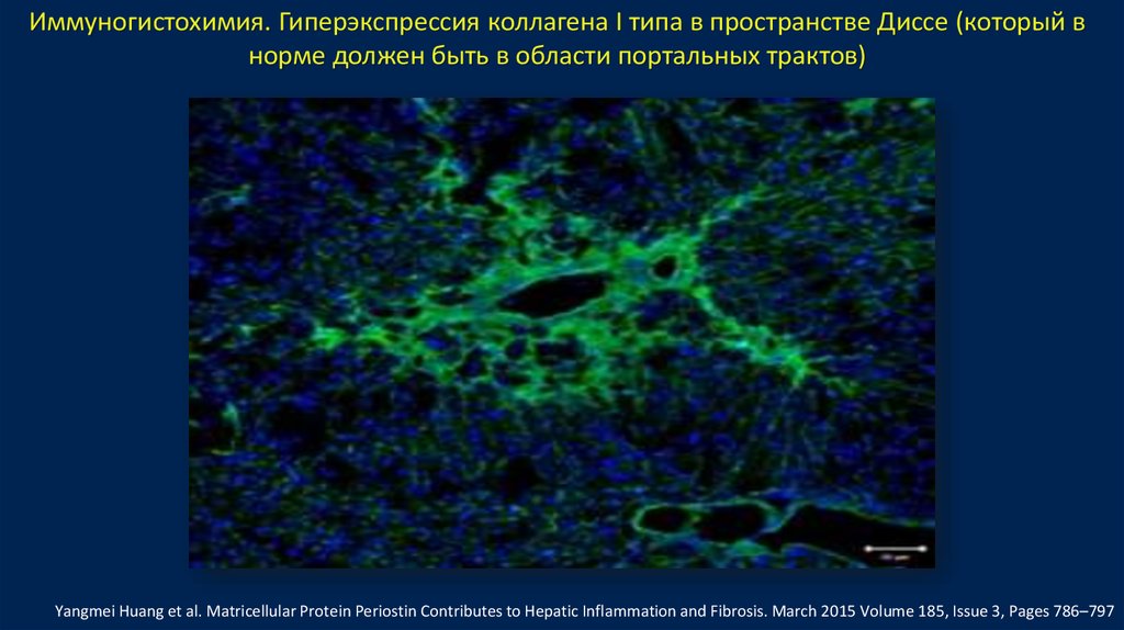 Huang et al. Иммуногистохимия. Иммуногистохимия картинки. Гиперэкспрессия это. Очаговая гиперэкспрессия ПСМА это в медицине.