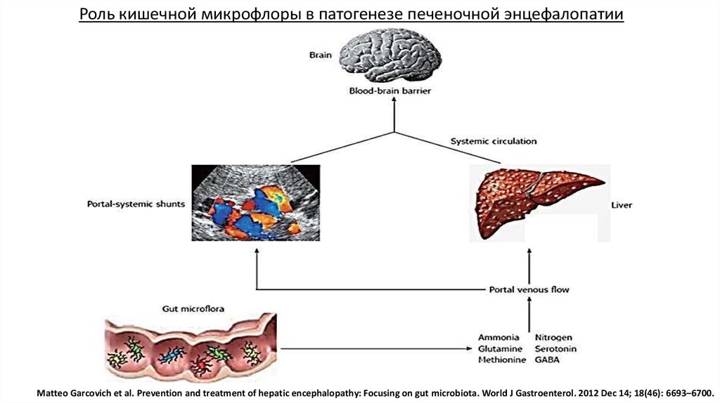 Патогенез печеночной энцефалопатии схема